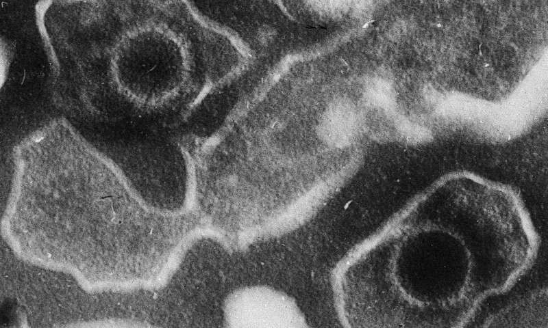 Yedi ciddi hastalığa bağlı Epstein Barr virüsü