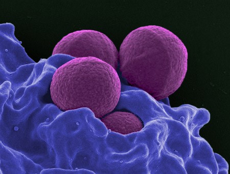 “superbug” artık yeter. Akçaağaç şurubu, antibiyotiğin etkisini arttırır.